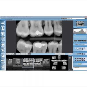 PLANMECA ProSensor HD