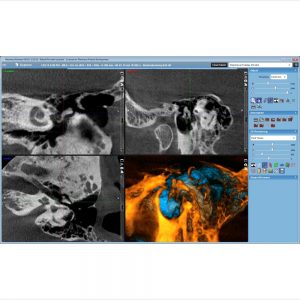 PLANMECA ProMax 3D Classic - Image 5